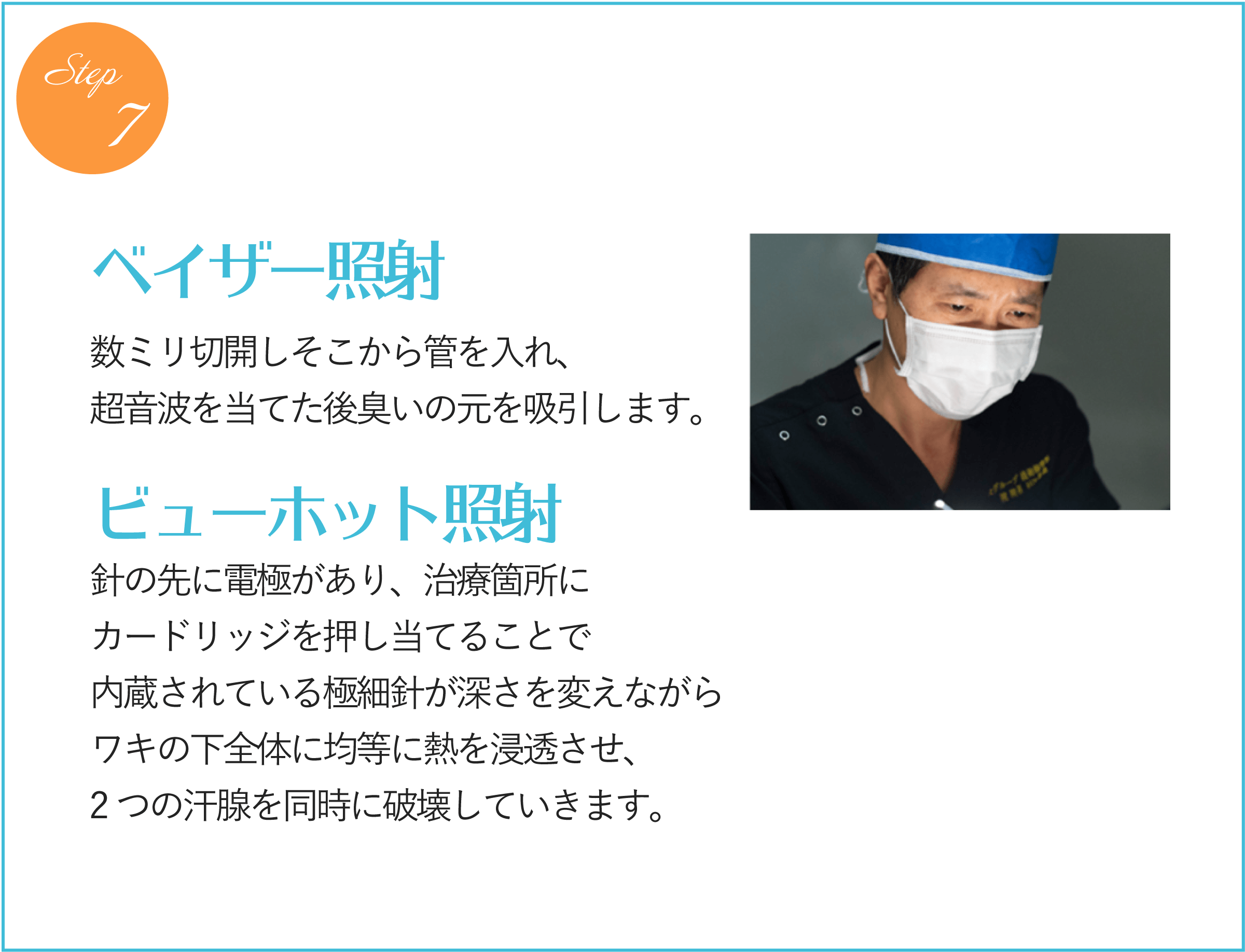 ベイザー照射・ビューホット照射